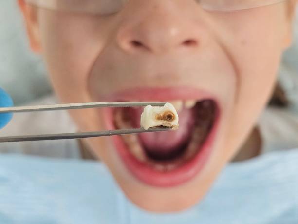 Best Pediatric Emergency Dentist in West Pittston, PA